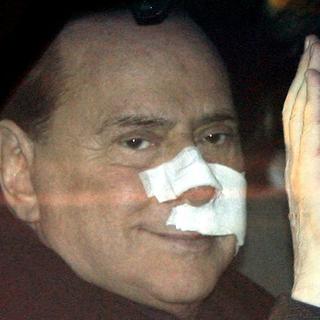 Zranený Berlusconi sa chystá