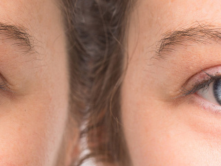 Šedý zákal je tichý