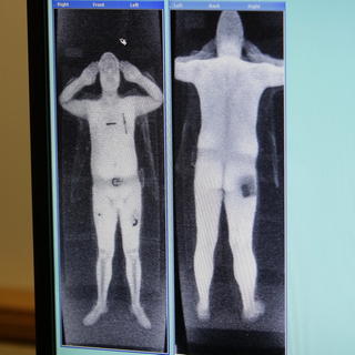 Taliani chcú telesné skenery