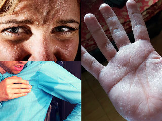 Zbavte sa nežiaduceho potenia