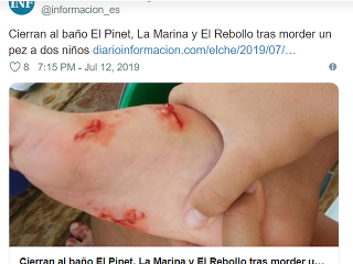 Záhadne dohryzené deti: V