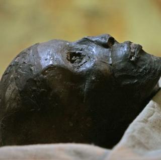 Tutanchamón zomrel pre zlomenú