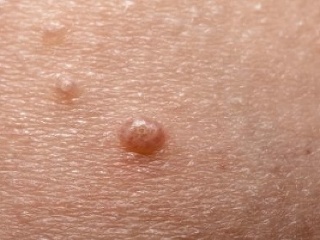 Molusky: Viete čo to