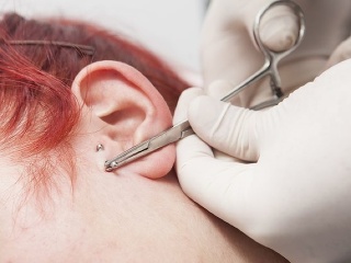 Postrach menom keloidná jazva: