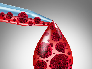 Inovatívna liečba pre pacientov