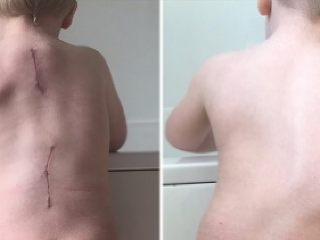 Chlapcove pľúca zničila jeho