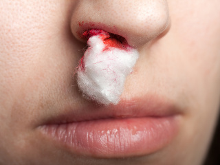 Príznaky, ktoré sa pri