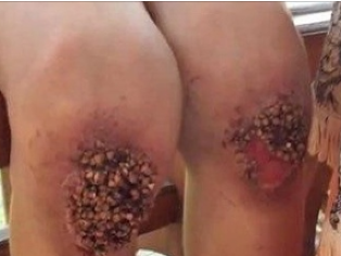 Sadisticky otčim nechal chlapca