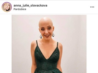 Anička Slováčková nosí holú hlavu s hrdosťou.