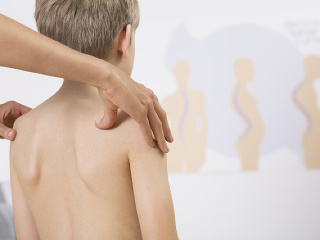 Scheuermannova choroba: Prezradí ju