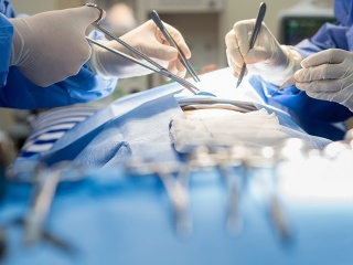 Plánujete operáciu? Môže sa