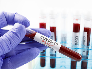 KORONAVÍRUS Počet obetí koronavírusu
