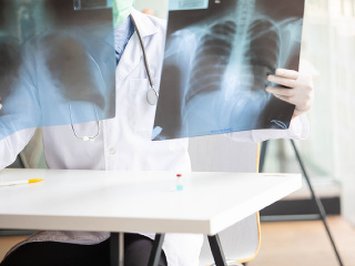 S koronavírusom bojuje o