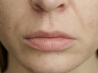 KORONAVÍRUS sa môže objaviť