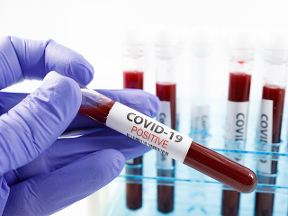 KORONAVÍRUS Z ochorenia COVID-19