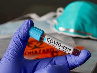 KORONAVÍRUS Na ochorenie COVID-19