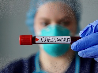 KORONAVÍRUS Vedci skúmali patogén