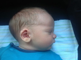 Skafocefalia: Strašiak, ktorého si