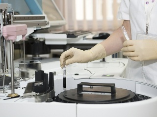 Koronavírus pod lupou: Tento