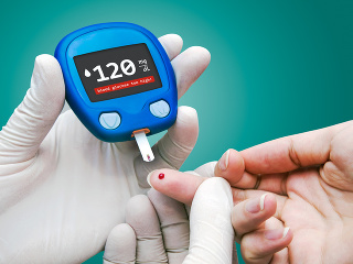 TOP korenie, ktoré vás