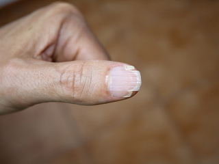 SIGNÁLY, ktoré vysiela choré