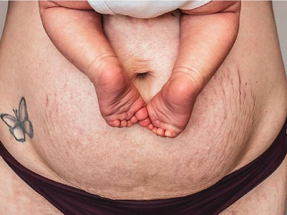 Svoje brucho považovala za