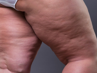 Najlepšie potraviny, ktoré vám