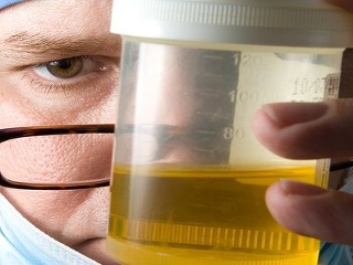 VIDEO Nechutný ZVYK muža,