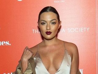 Známa modelka otvorene prehovorila