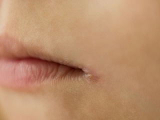 Výsledok bežného ZLOZVYKU: Ochorenie,