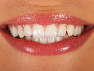 MINERÁL, z ktorého bude