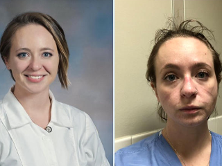 Zdravotné sestry zverejňujú selfie,