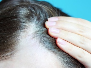 Za rednutie vlasov si