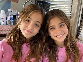 Najkrajšie dvojičky na svete