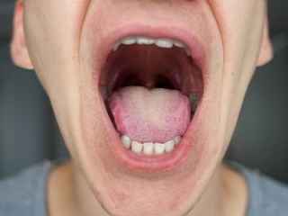 FOTO KORONAVÍRUS môže dať