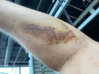 NESPRÁVNE cvičenie sa vám