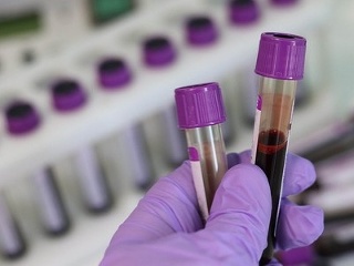 Muž kúpil svojej priateľke