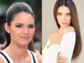 Kendall Jenner pred 10