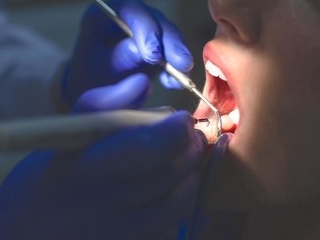 Riziko vzniku CUKROVKY a