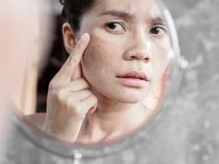 Tri signály na pokožke,