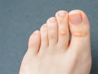 NECHTY na nohách ako