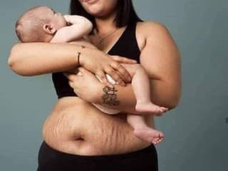 Telo po pôrode: Tieto