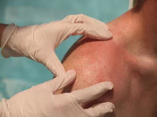 SIGNÁL, že telo bojuje