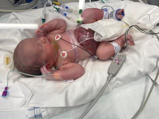 Millie - dievčatko, ktoré