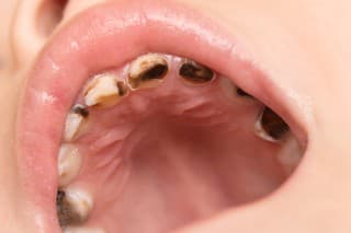 Top potraviny, ktoré najviac