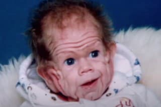 Ako dnes vyzerá dieťa,