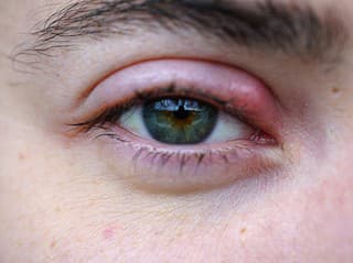 ZÁHADA s názvom JAČMEŇ