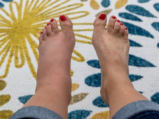 VYTIAHNU prebytočnú TEKUTINU z