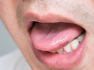 Zvláštny JAV u muža