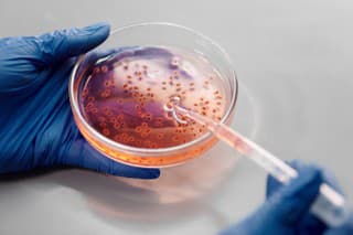 Časti bunky, ktoré sú